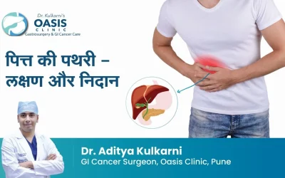 Gallstone: Symptoms and Diagnosis