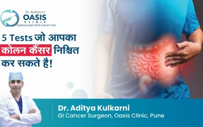 5 Tests to Identify Colon Cancer?