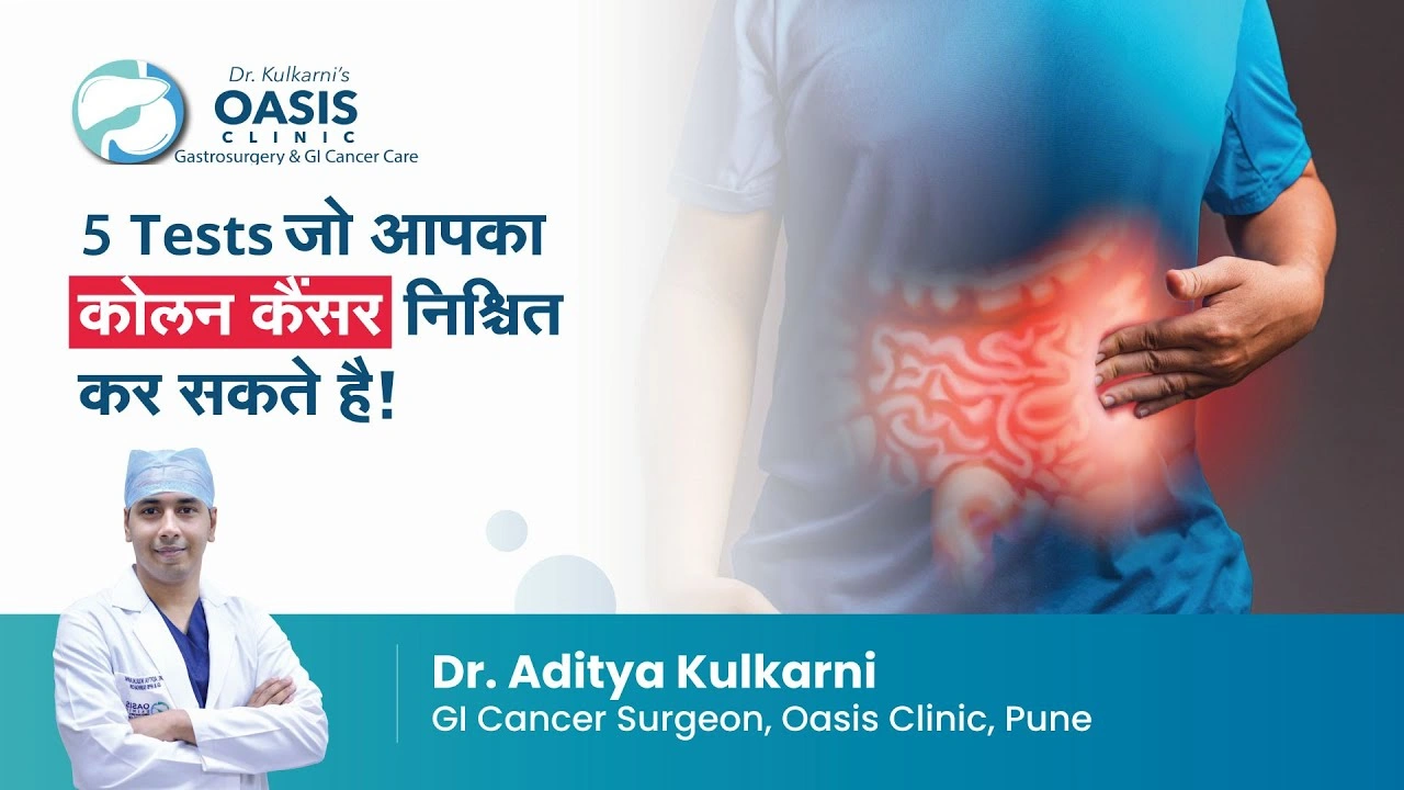 5 Tests to identify Colon Cancer?
