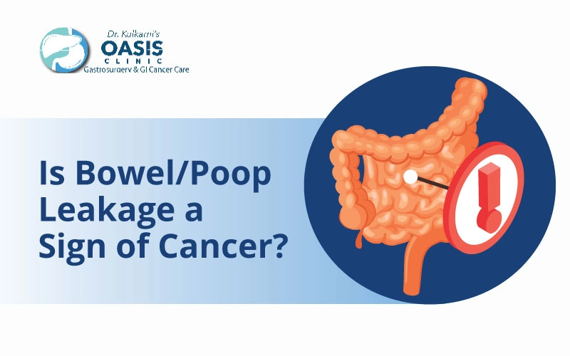 is bowel poop leakage a sign of cancer