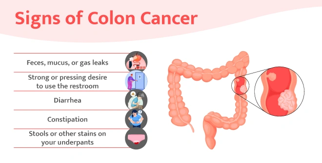 sign of colon cancer