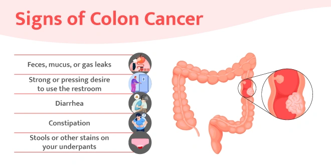 colon cancer stool pictures