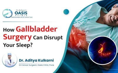 How Gallbladder Surgery Can Disrupt Your Sleep?