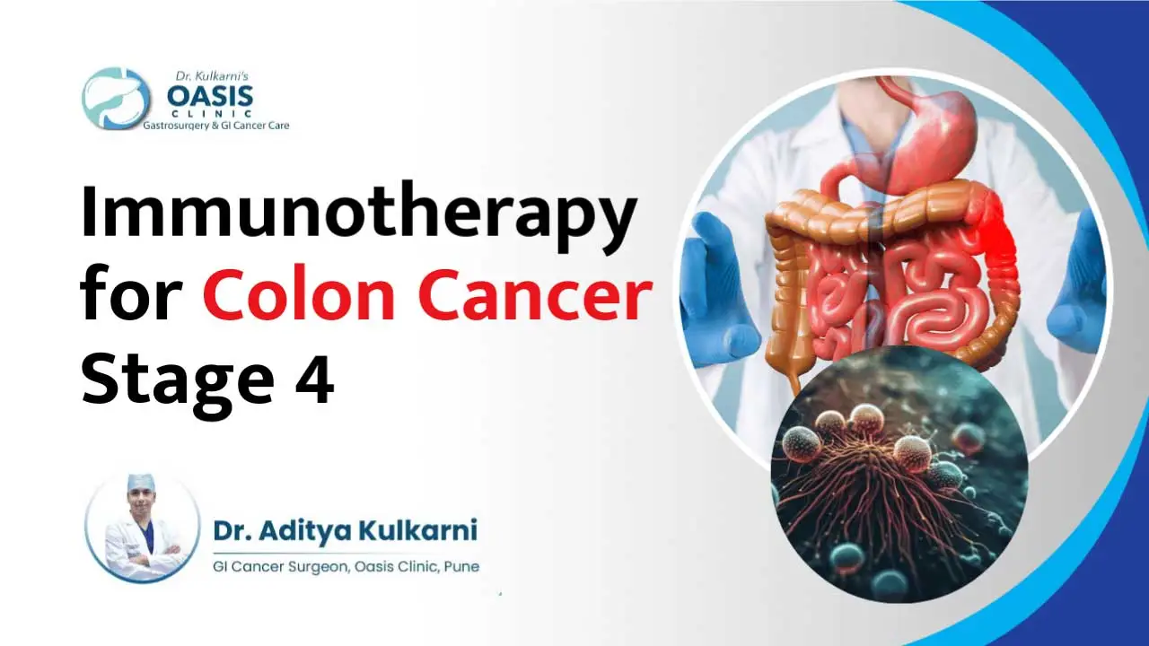 Immunotherapy for Colon Cancer