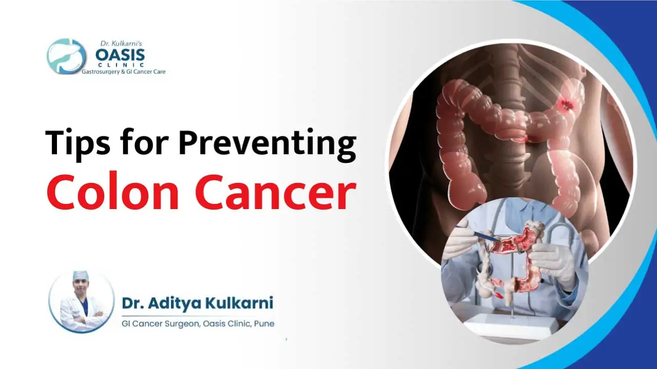 Tips to Prevent Colon Cancer