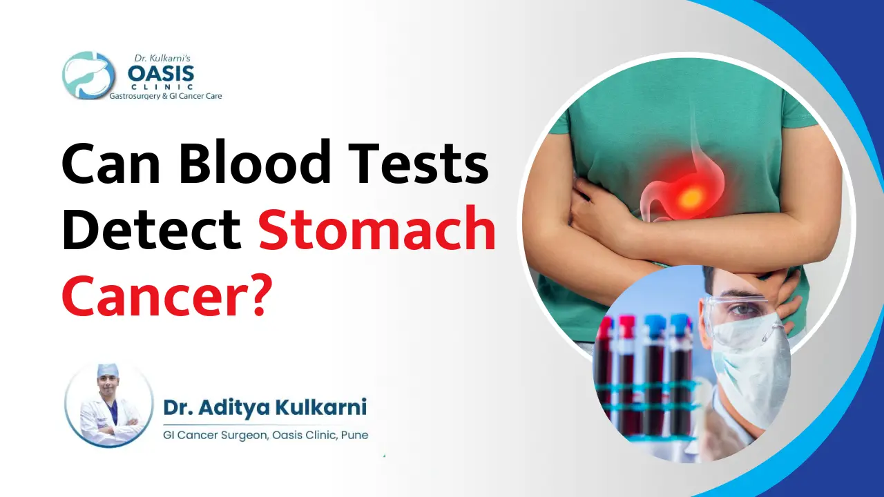 can blood tests detect stomach cancer