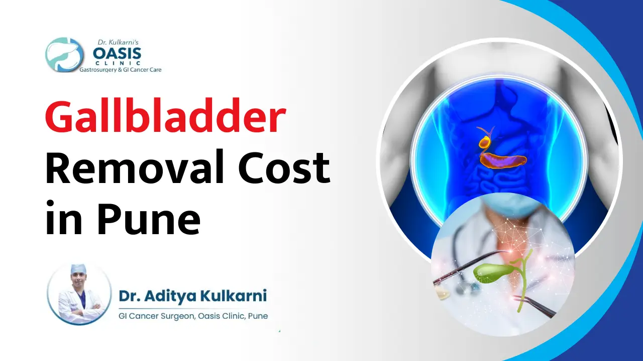 gallbladder removal cost in Pune