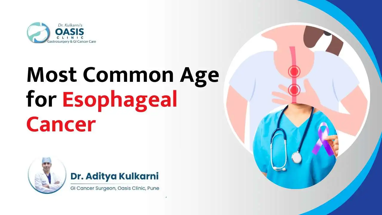 Esophageal Cancer common age