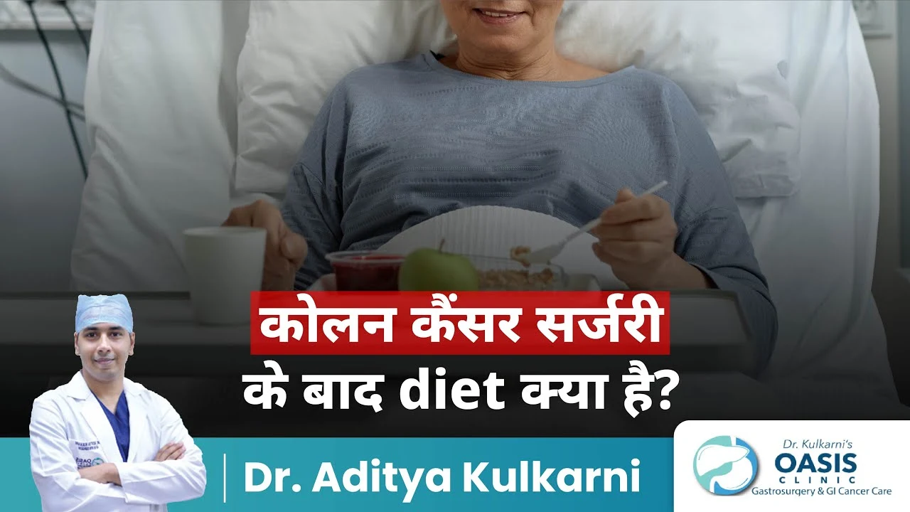 diet post colon cancer surgery