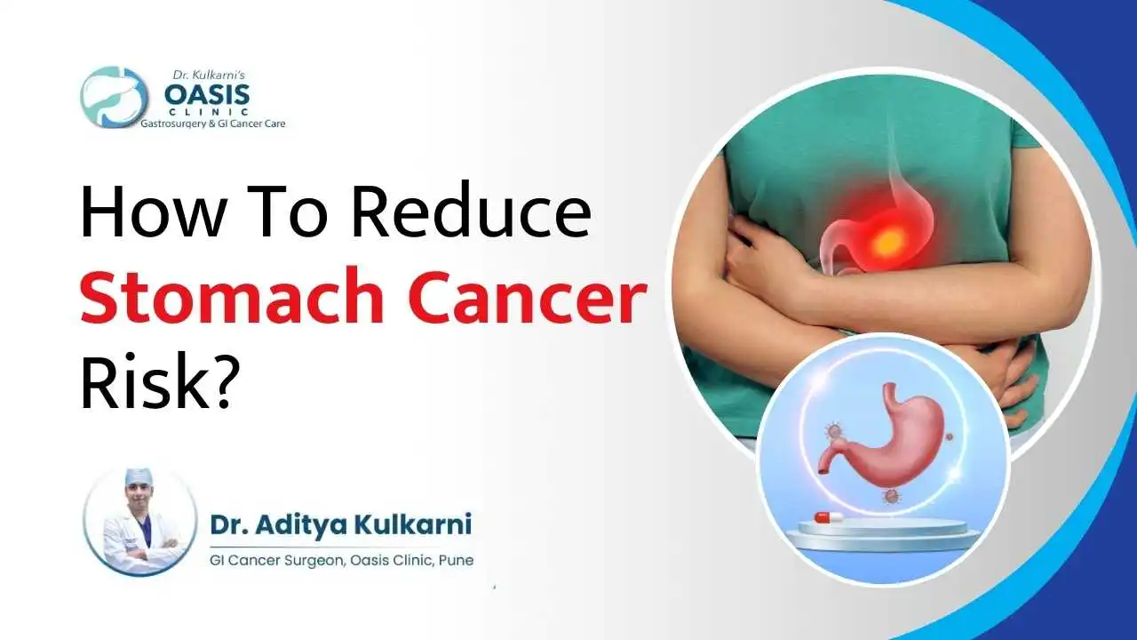 steps to reduce the risk of stomach cancer