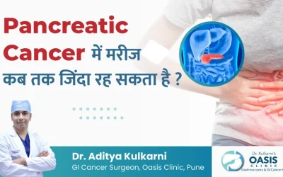 Survival Rates in Pancreatic Cancer