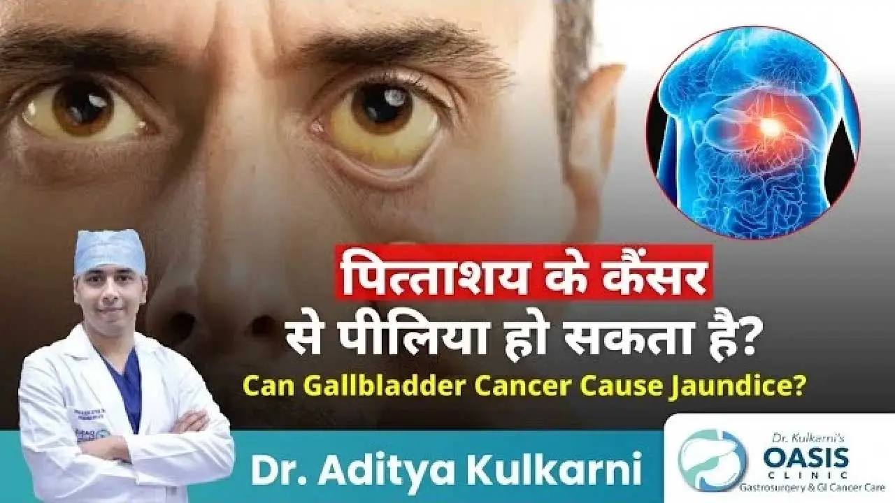 Can Gallbladder Cancer Cause Jaundice?