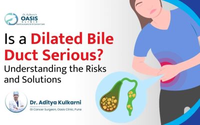 Is  Dilated Bile Duct Serious? Risks and Solutions Explained