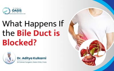 What Happens If the Bile Duct is Blocked?