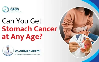 Can You Get Stomach Cancer at Any Age?