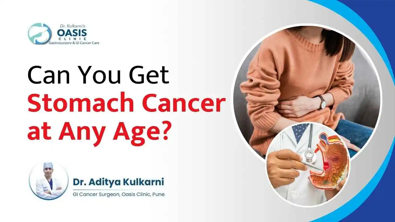 Can You Get Stomach Cancer at Any Age?