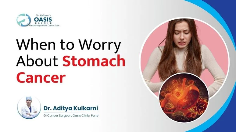 when to worry about stomach cancer