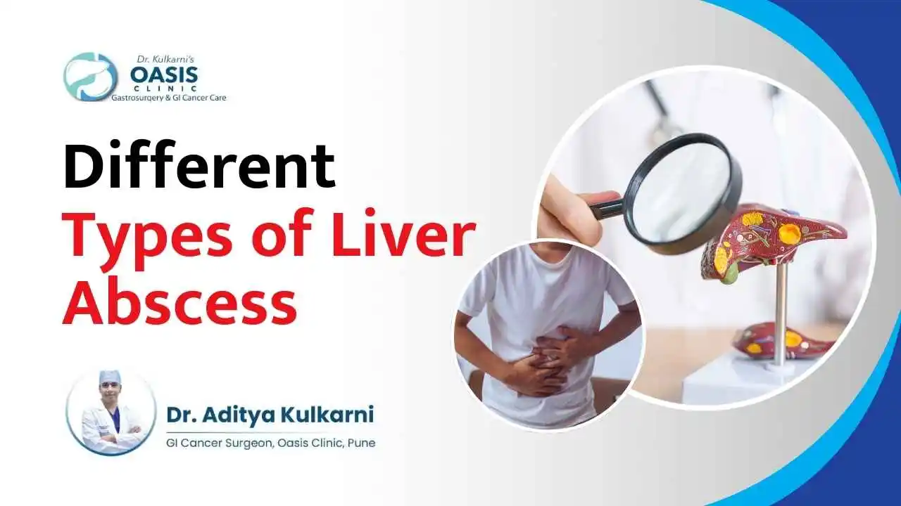 Different Types of Liver Abscess