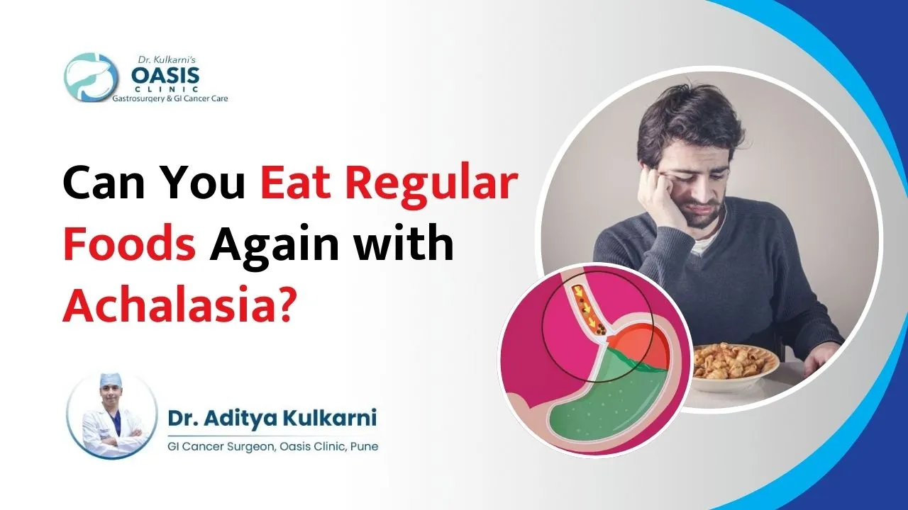 Can You Eat Regular Foods Again with Achalasia?