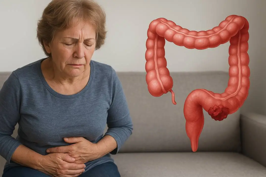 Can Long-Term Constipation Cause Colon Cancer? Can Long-Term Constipation Cause Colon Cancer?