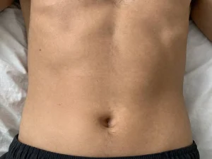 Upper abdomen close-up with natural skin tones