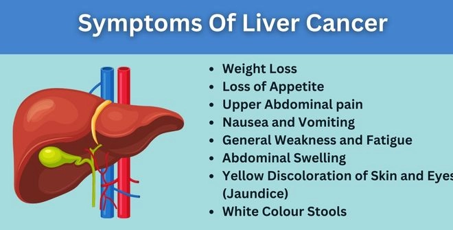 Symptoms Of Liver Cancer